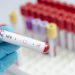 HIV vaccine shows promise in human trial