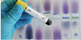 UNAIDS urges a scaling up of HIV vaccine research to stop new infections
