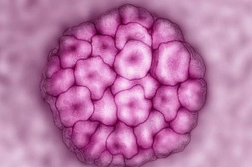 Cervical cancer: Australia ‘to be first to eliminate disease’