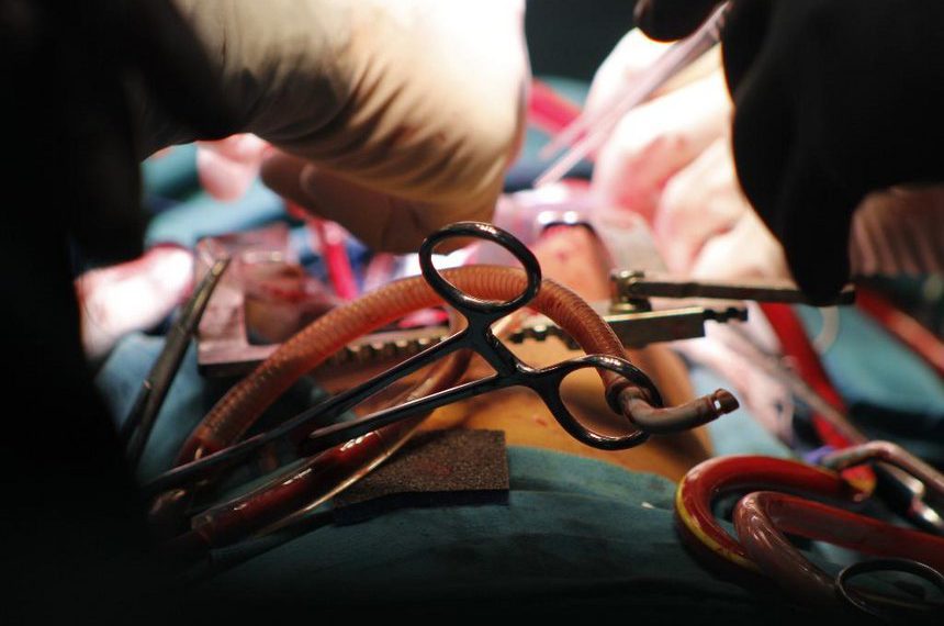 Why more women die of heart attacks