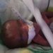 Baby born size of an apple defies odds to survive