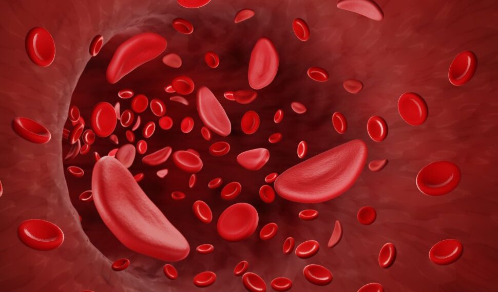 African health Ministers launch drive to curb sickle cell disease toll