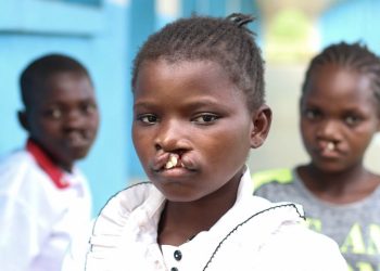 Nairobi’s Bela Risu Medical Centre performs over 7,000 free cleft lip and palate surgeries