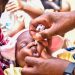 Zimbabwe Starts an Emergency Polio Vaccination Drive After Detecting Cases Caused by a Rare Mutation