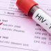 MoH refutes claims over poor quality of HIV testing services in the country