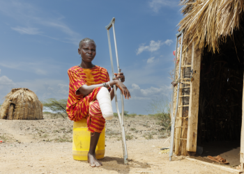  A Thorn in the Flesh, Pain and Stigma: The Silent Scourge of Mycetoma in Turkana